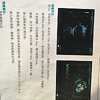 有能帮忙看看男宝女宝的吗，太好奇了