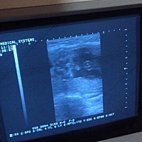 是男宝还是女宝