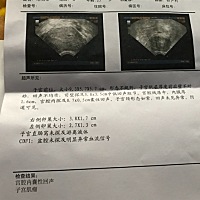 还有希望保住么？