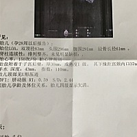 有会看的宝妈不，听说胎心率超过145就是女孩呀，而且目前我胎盘低置，是不是很可能早产，还需要剖腹呢�...
