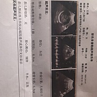 现在34周了，今天去检查双顶径8.8医生说孩子发育大，有没有孕妈妈跟我一样