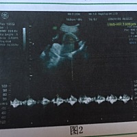孕期也要保养，要是不保养生完孩子就成黄脸婆了，哪样是很难保养回来的，生完孩子不想肚子上有花纹，妊...