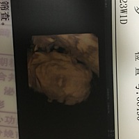 哈哈哈看看我们的锥子脸～