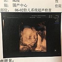 又害怕又期待，这个神奇的小生命不久两个月就会来临，不知道未来会怎么样，期待他平安健康，快快乐乐的！