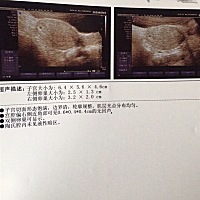 姐妹们你们有跟我一样的么，着床位置好边边，会长到中间去吗？