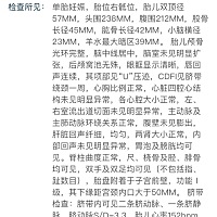 怀孕26周 和31周的B超图