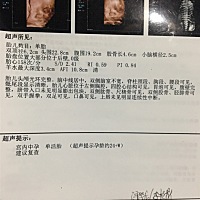 有会看男孩女孩的宝妈吗