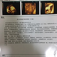 麻烦大家帮忙看看是男宝宝还是女宝宝。谢谢