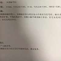 宝宝脑白质软化，我还在坐月子，怕家人担心，只敢每天晚上偷偷的流眼泪！