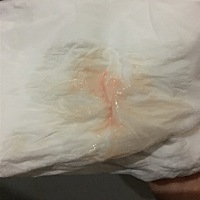 刚才去卫生间出血了 好担心啊