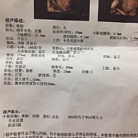 有四维通过医生推荐做胎儿心脏B超的吗？ 你们都做了吗？