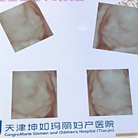 四维顺利通过😊