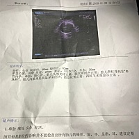 怀孕34周了，彩超检查结果是32周，是宝宝太小了吗？这几天感冒严重，鼻子不透气，流鼻涕，咳嗽。喉咙好...
