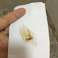 怀孕20多天的时候有出现微粉，然后见红，最后去医院查了孕酮和hcg指标都正常，吃了保胎药和孕酮过了3 4...