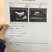 为什么每次产检都都1千多   11周做NT 什么的用了2千多    昨天去做了个这个用了500多    感觉其他孕妈都...