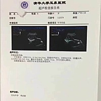 大家帮看看这是个男孩还是女孩