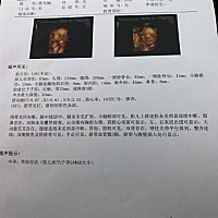 四维彩超有没有会看的