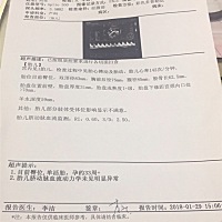 今天去医院检查了一下，医生说贫血开了药