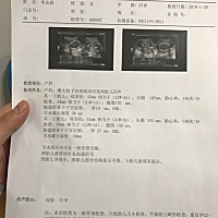 求各位美丽的宝妈妈看看我的俩宝宝是男孩女孩 谢谢啦 万分感谢🙏