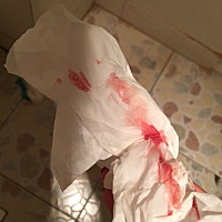 时不时就会有出血情况。这是要卧床休息，不能上班了吗