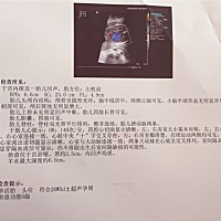 亲爱的宝妈们会看b超单子的帮忙看看这单子是男孩还是女孩，谢谢了