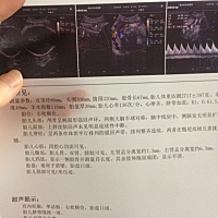 第四次B超还是分离。😢😢宝贝希望你健康。