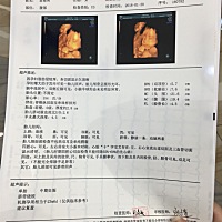 有孕妈妈会看四维的嘛！可以帮我看看嘛！