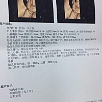 姐妹们这是男孩还是女孩呀