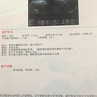 有会的吗 孩子有多重啊？