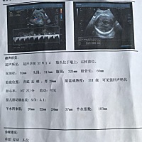 有朋友能帮忙看下男孩女孩吗？谢谢