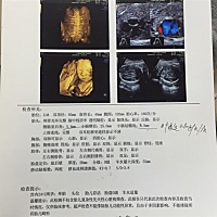 各位有经验的宝妈们，看看男 女呗！心情很激动，特别好奇