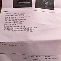 今天刚做的检查、帮我看一下是像男孩还是女孩，、我都喜欢、只是好奇也期待