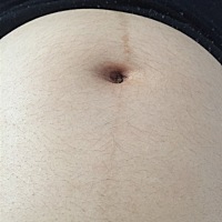 刚刚肚脐眼附近一直跳动怎么回事！和心跳差不多