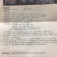 心脏彩超通过啦…… 好开心！虽然并不想做那么多检查 但是为了宝贝一切都是值得的！