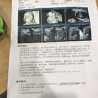 快要生了，马上就知道宝宝的性别了，各位觉得是男孩女孩呢，娱乐而已^_^