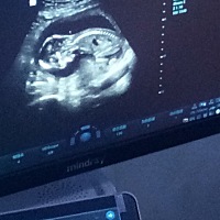 第一次知道你是男孩子的时候