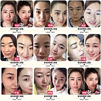 今日推荐[玫瑰]麦吉丽贵妇膏：❶提亮美白、❷淡痘印、❸淡斑、❹去暗黄、❺收缩毛孔、❻修复红血丝、❼...