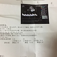 会看b超数据的朋友们，帮忙看看这是33周b超单子，帮忙看看男孩还是女孩，谢谢了