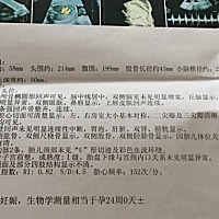 有懂看男女的吗？