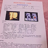 可以看出男娃还是女娃，接女娃