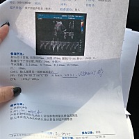 因为最近生气宝宝好像都受到影响了，动不停