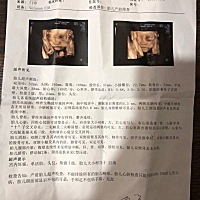 各位大神，这个能看出，男孩女孩吗？