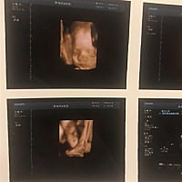 小家伙你天天不睡觉么 一天24小时在动