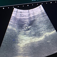 你能看出男孩女孩吗？已经查过血了！不知道查血准不准！