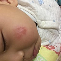 亲们，帮忙看下宝宝脸上长的是什么东西，天气一暖和脸上就好，一冷就有，咋回事