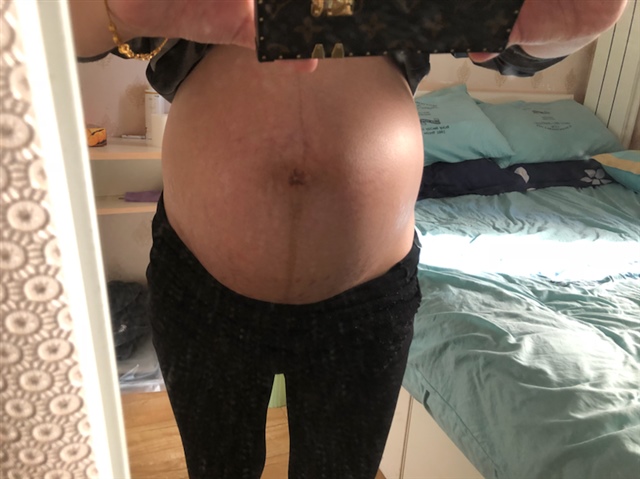 肚脐周围已经撑得亮晶晶的了☹️