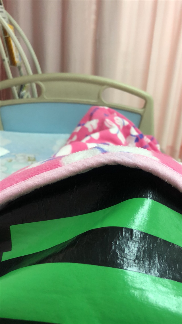 34周胎监拍摄