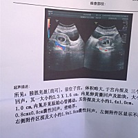 从开始怀孕附件就有囊肿，上周去查又大了，大家帮忙看看怎么办