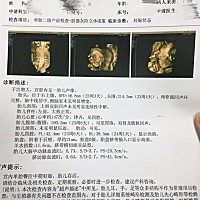 这是1月12号做的三维彩超，有谁看得懂的帮我看看是男宝还是女宝