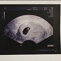 话说能看出这是什么性别吗？我反正看不来。